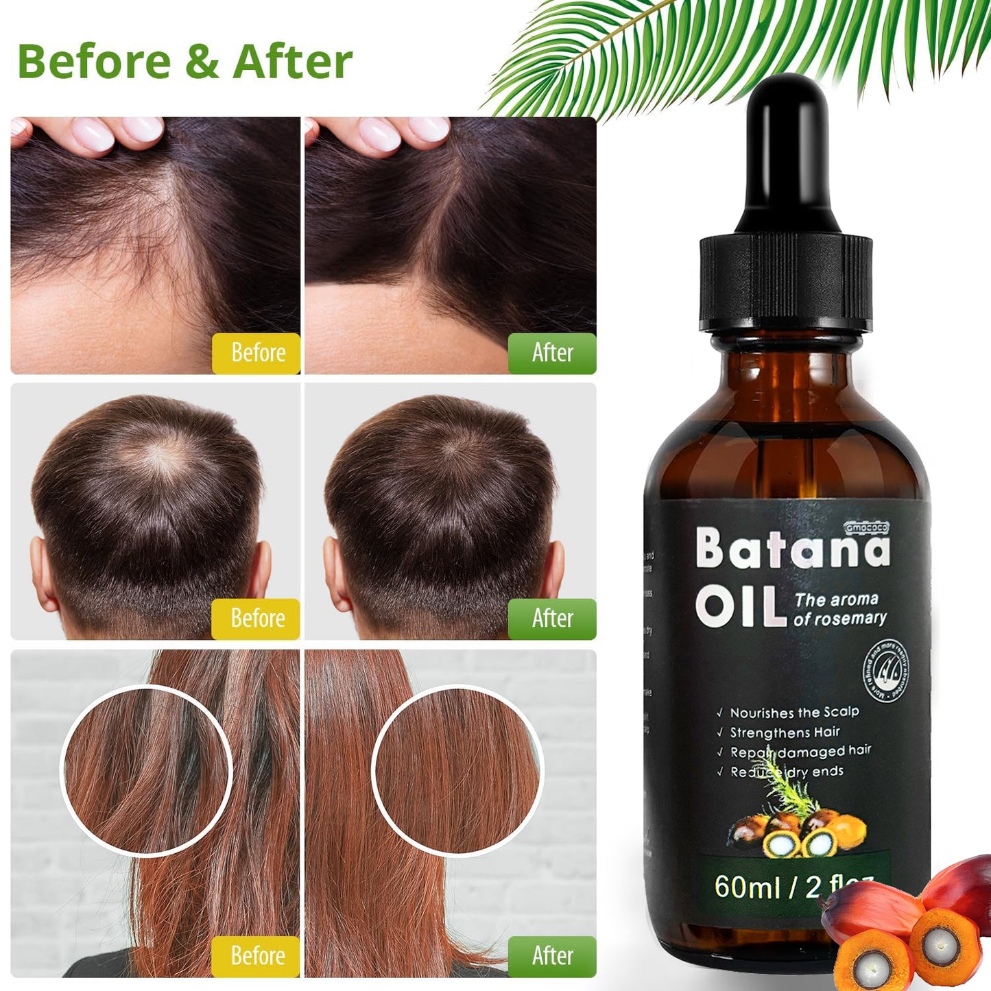 Only Supports Self Pickup With Waybill Amococo Batana Oil With Rosemary Cold Pressed Natural Hair Growth Oil, Nourishes Scalp, Repairs Damaged Hair, Reduces Split Ends, Boosts Hair Thickness &