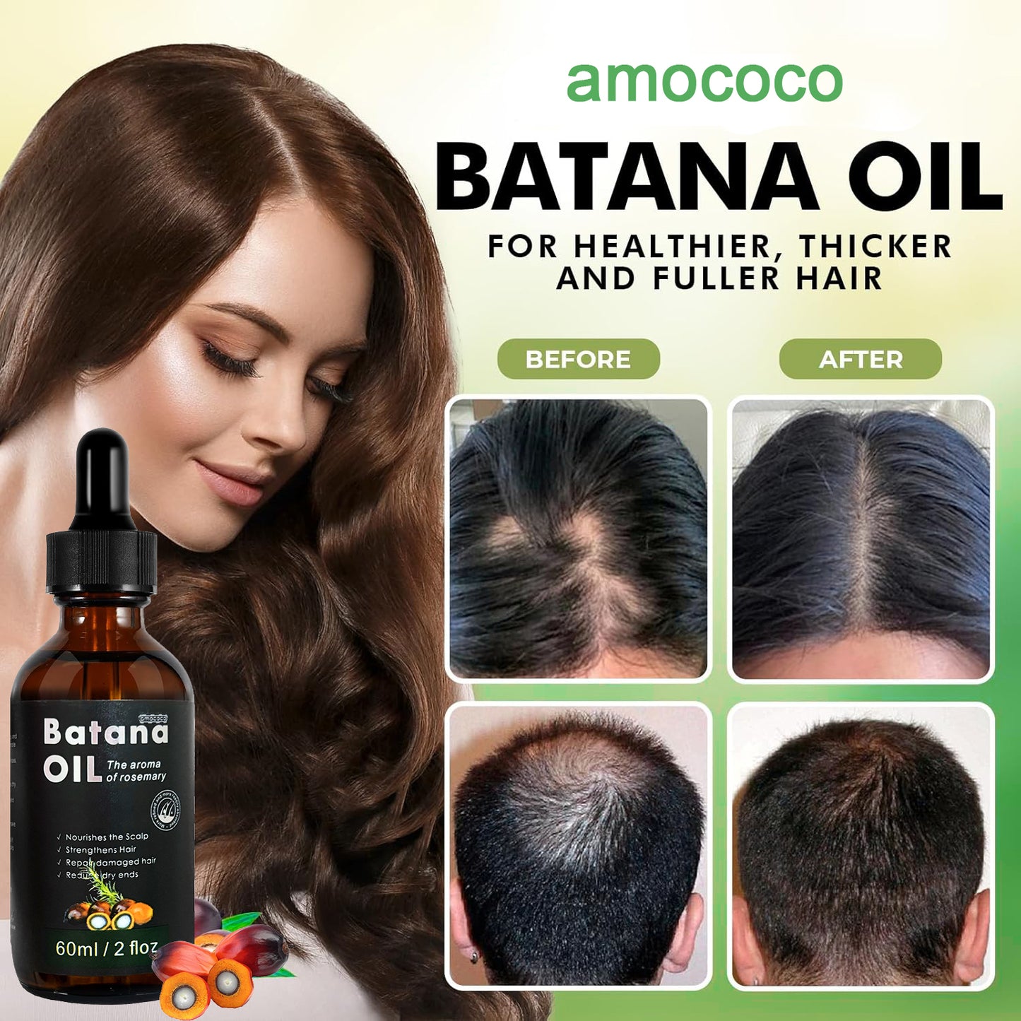 Only Supports Self Pickup With Waybill Amococo Batana Oil With Rosemary Cold Pressed Natural Hair Growth Oil, Nourishes Scalp, Repairs Damaged Hair, Reduces Split Ends, Boosts Hair Thickness &