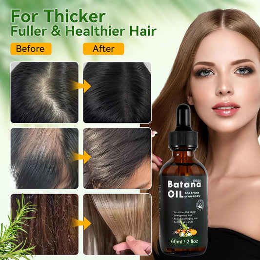 Only Supports Self Pickup With Waybill Amococo Batana Oil With Rosemary Cold Pressed Natural Hair Growth Oil, Nourishes Scalp, Repairs Damaged Hair, Reduces Split Ends, Boosts Hair Thickness &