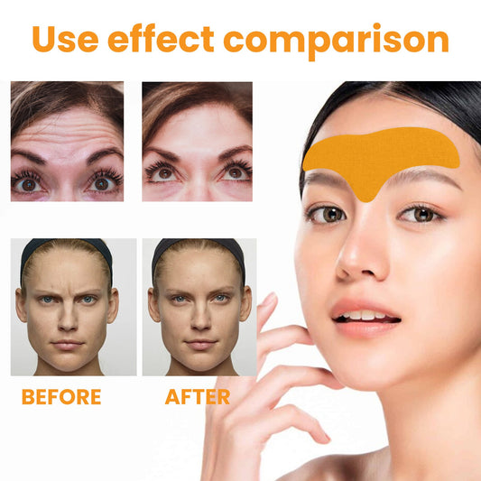 Forehead Wrinkle Patch,Anti-Wrinkle Forehead Patches With Collagen & Centella Asiatica For Frown Lines, Wrinkles, Fine Lines