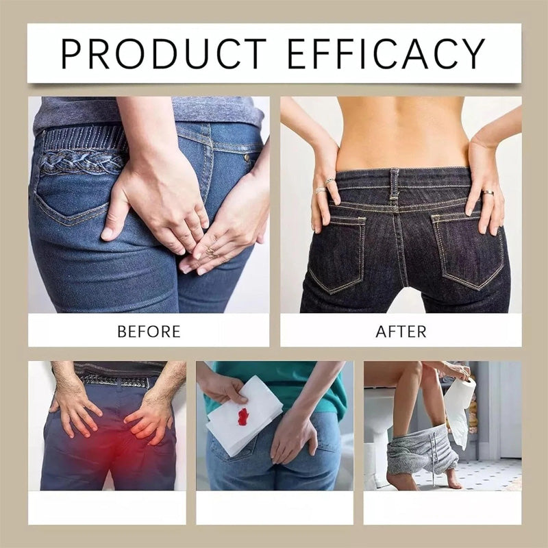 Hemorrhoids Remove Herbal Cream Relief Piles Pain Reduce Itching,Natural Herbal Hemorrhoids