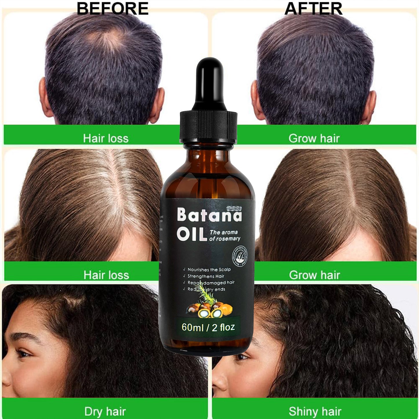Only Supports Self Pickup With Waybill Amococo Batana Oil With Rosemary Cold Pressed Natural Hair Growth Oil, Nourishes Scalp, Repairs Damaged Hair, Reduces Split Ends, Boosts Hair Thickness &