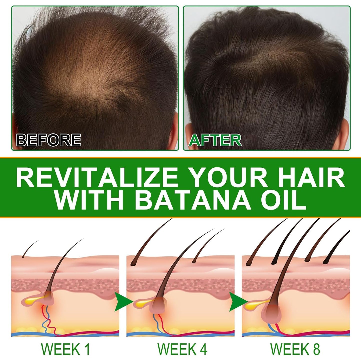Only Supports Self Pickup With Waybill Amococo Batana Oil With Rosemary Cold Pressed Natural Hair Growth Oil, Nourishes Scalp, Repairs Damaged Hair, Reduces Split Ends, Boosts Hair Thickness &