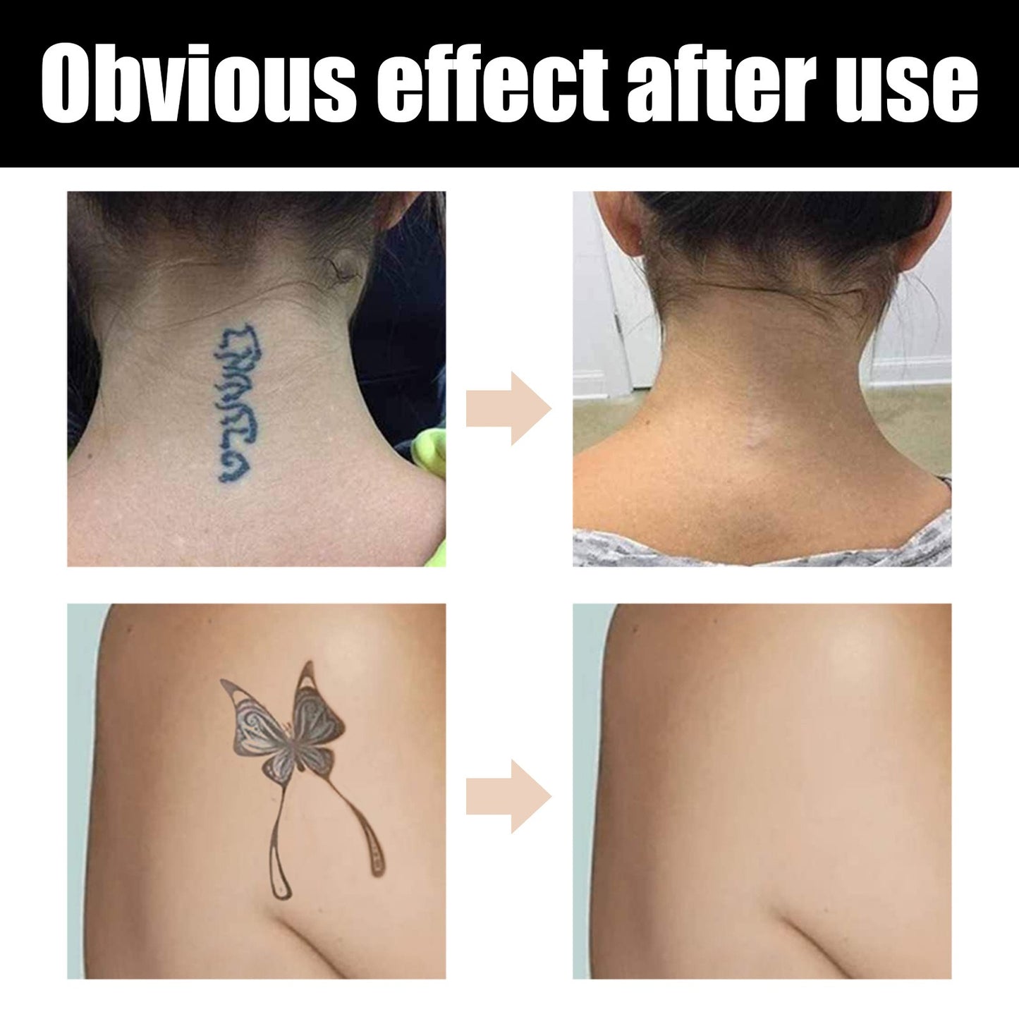 Tattoo Cover Up Makeup Waterproof, Professional Tattoo Concealer Use On Body, For Legs, Dark Spots, Scars, Vitiligo